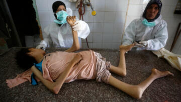 Gazze’de açlık nedeniyle ölümler sürüyor! Bir kız çocuğu hayatını kaybetti