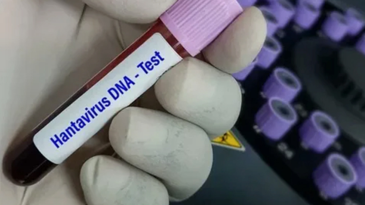 DSÖ’den gemide ortaya çıkan Hantavirüs için risk açıklaması