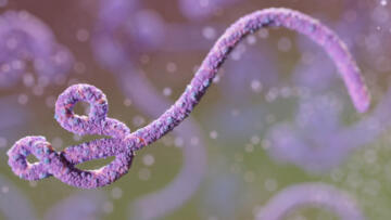 Fransa’da bu dönemde ilk kez Ebola virüsü vakası görüldü